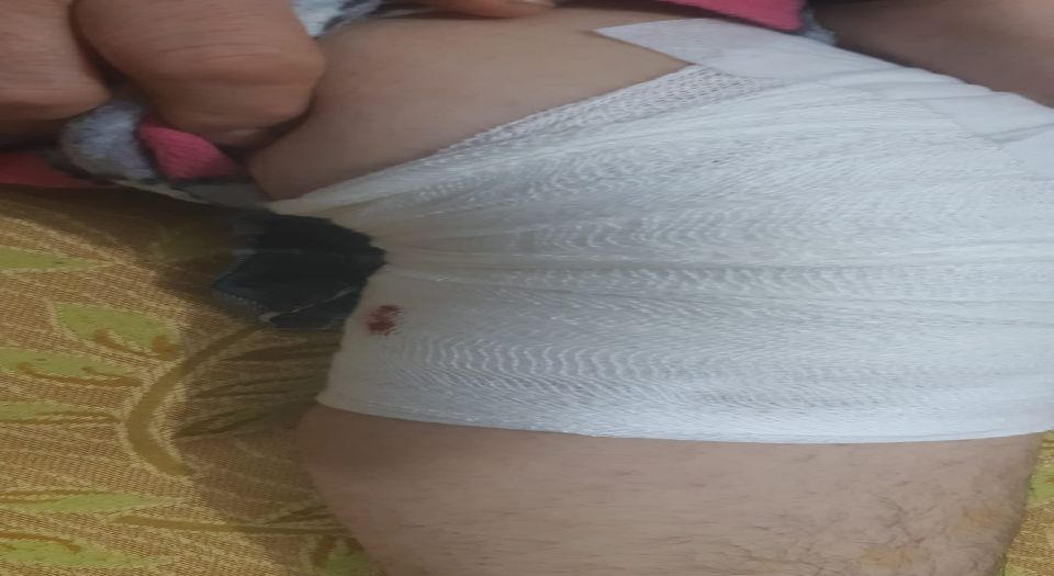Siirt'te genç kız köpek saldırısında yaralandı